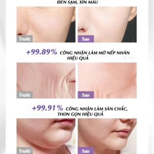 Alternative view of Kem Dưỡng Ẩm Dưỡng Sáng Chống Lão Hóa - OHBT Pro-Xylane & Arbutin Soothing & Moisturizing